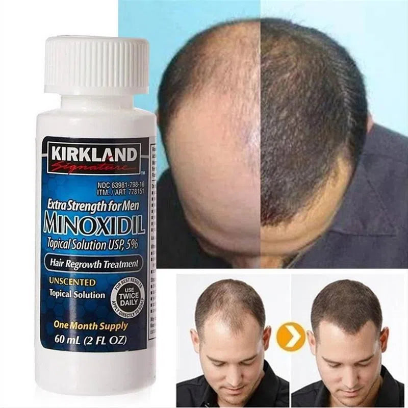 Minoxidil Para barba y cabello